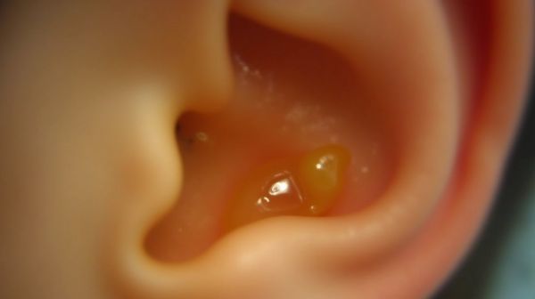 Évacuer l'eau des oreilles pour éviter les infections